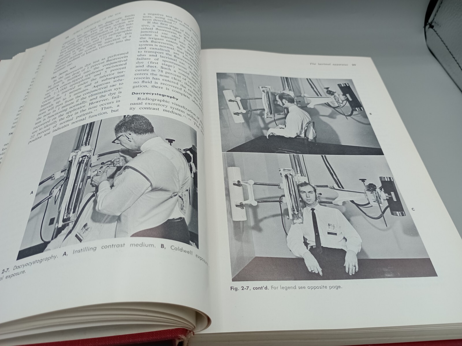 Adler’s Physiology Of The Eye, Clinical Application, Robert A. Moses, Fifth Ed