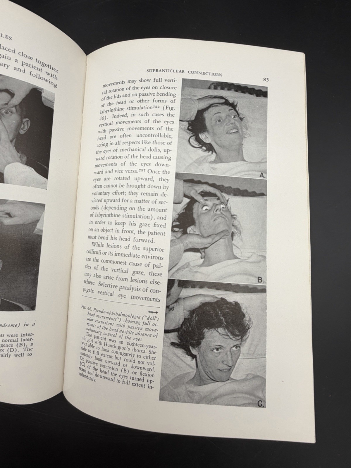 Neurology of the Ocular Muscles 1948 David G Cogan MD First Edition Medical Book