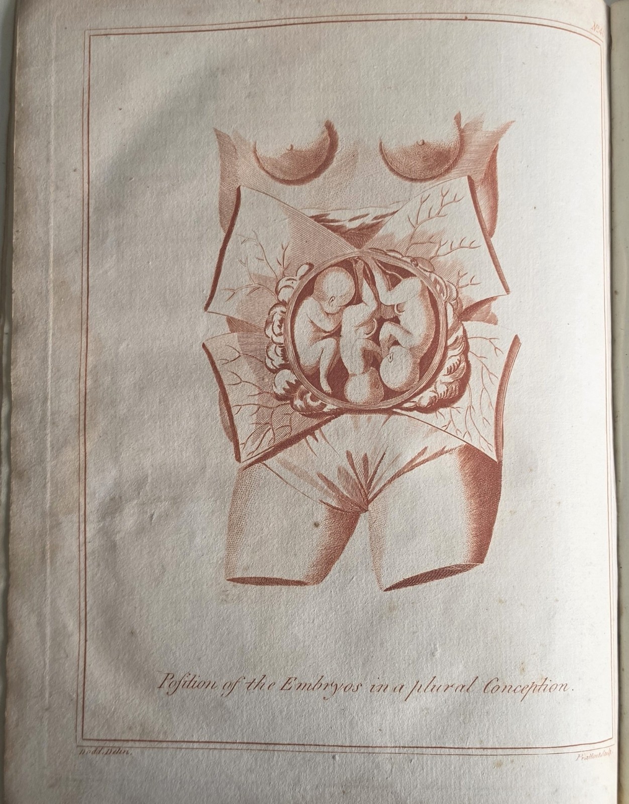 Culpeper English Physician Herbal Medical Part c1790s Sibly Occult Anatomy