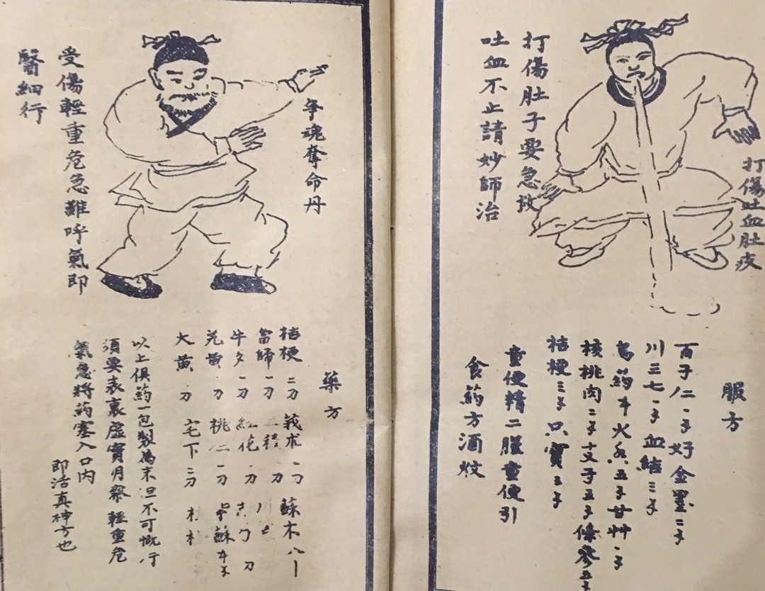 Collection of 12 China Old Books on Witch Medicine,Traditional Chinese Medicine