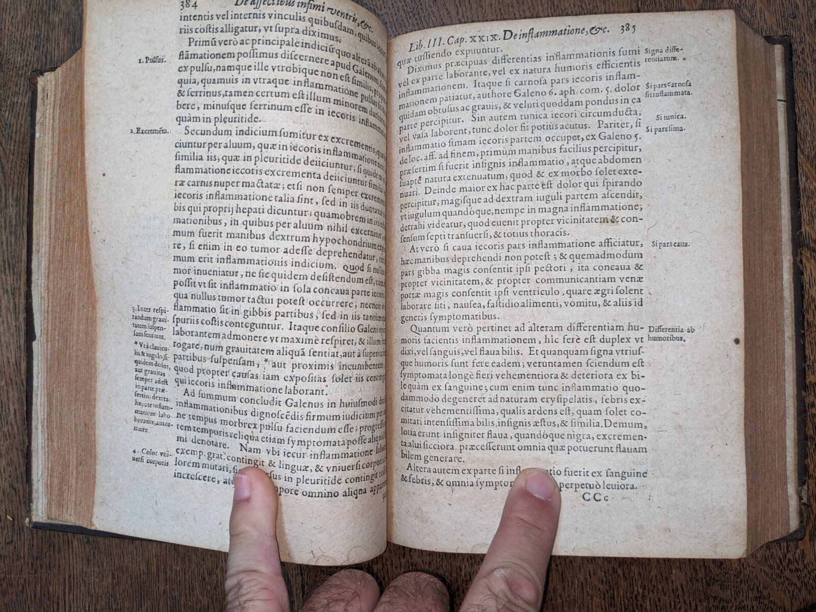 old book-D. Hieronymi Fabricii ab aquapendente …. Médicina practica-1634